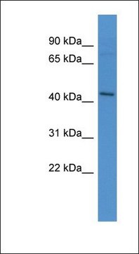 Anti-APLNR antibody produced in rabbit affinity isolated antibody