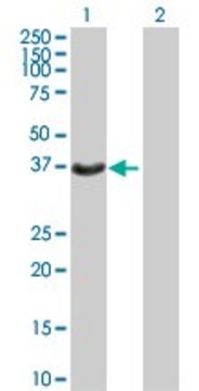 Anti-HSD17B2 antibody produced in mouse IgG fraction of antiserum, buffered aqueous solution