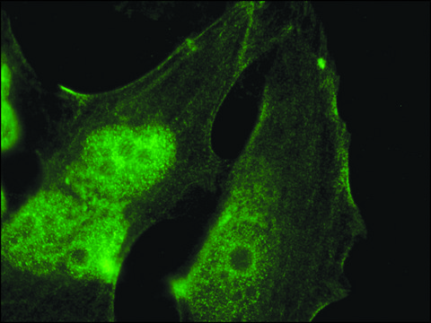 Anti-Palladin (C-terminal) antibody produced in rabbit IgG fraction of antiserum, buffered aqueous solution