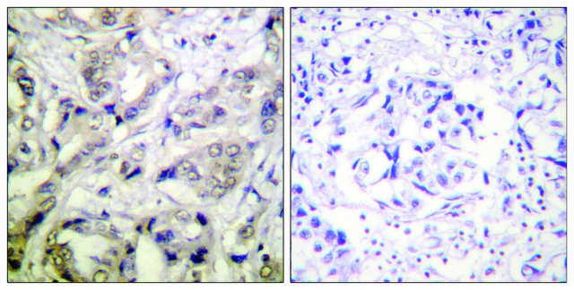 Anti-CAMK1-&#945; antibody produced in rabbit affinity isolated antibody