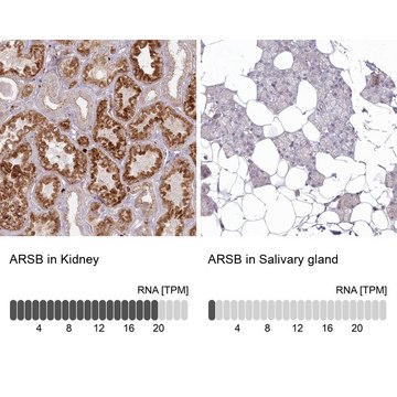 Anti-ARSB antibody produced in rabbit Prestige Antibodies&#174; Powered by Atlas Antibodies, affinity isolated antibody, buffered aqueous glycerol solution