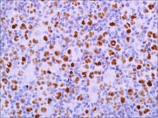 BCL6 (EP278) Rabbit Monoclonal Primary Antibody