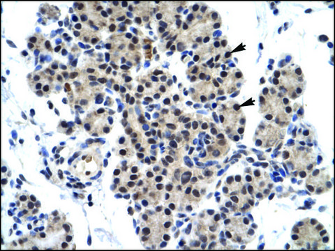 Anti-ZNF318 antibody produced in rabbit affinity isolated antibody