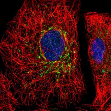 Anti-SLC25A35 antibody produced in rabbit Prestige Antibodies&#174; Powered by Atlas Antibodies, affinity isolated antibody, buffered aqueous glycerol solution