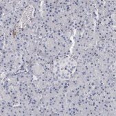 Anti-TNR antibody produced in rabbit Prestige Antibodies® Powered by Atlas Antibodies, affinity isolated antibody, buffered aqueous glycerol solution, Ab1