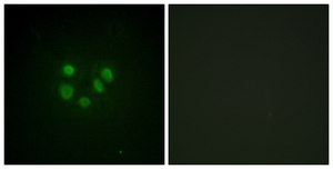 Anti-Bloom Syndrome antibody produced in rabbit affinity isolated antibody