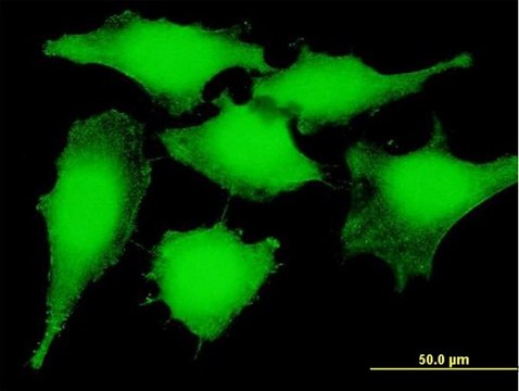 Anti-PSMB5 antibody produced in mouse purified immunoglobulin, buffered aqueous solution