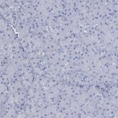 Anti-DMC1 antibody produced in rabbit Prestige Antibodies® Powered by Atlas Antibodies, affinity isolated antibody, buffered aqueous glycerol solution
