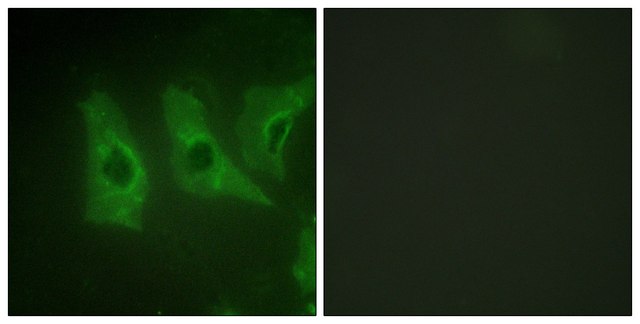 Anti-CKI-&#945; antibody produced in rabbit affinity isolated antibody