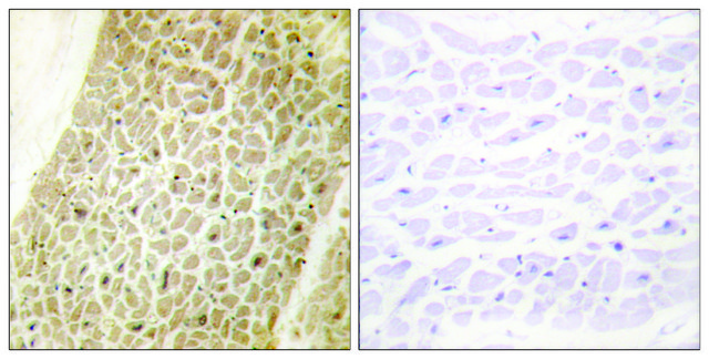 Anti-AKAP8 antibody produced in rabbit affinity isolated antibody