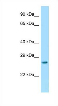 Anti-HPRT antibody produced in rabbit affinity isolated antibody