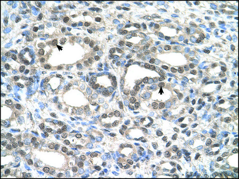 Anti-DFNA5 antibody produced in rabbit IgG fraction of antiserum