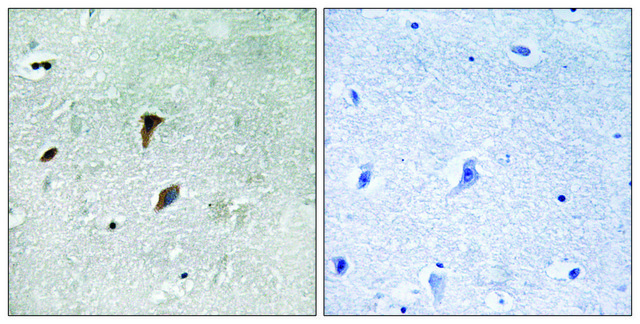 Anti-phospho-MAP2K3 (pThr222) antibody produced in rabbit affinity isolated antibody