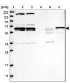 Anti-PPIL2 antibody produced in rabbit Prestige Antibodies® Powered by Atlas Antibodies, affinity isolated antibody, buffered aqueous glycerol solution
