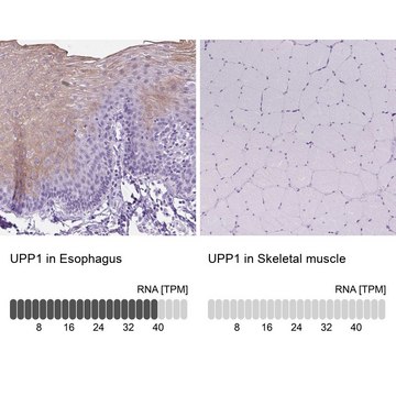 Anti-UPP1 antibody produced in rabbit Prestige Antibodies&#174; Powered by Atlas Antibodies, affinity isolated antibody, buffered aqueous glycerol solution