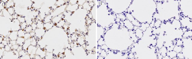 Anti-Prosurfactant Protein C (proSP-C) Antibody serum, Chemicon&#174;