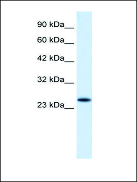 Anti-VPS24 antibody produced in rabbit affinity isolated antibody
