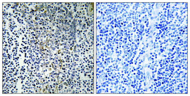 Anti-RPL23 antibody produced in rabbit affinity isolated antibody