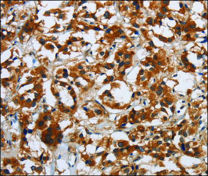 Anti-DSP antibody produced in rabbit affinity isolated antibody