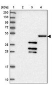 Anti-DNAJC3 antibody produced in rabbit Prestige Antibodies® Powered by Atlas Antibodies, affinity isolated antibody, buffered aqueous glycerol solution