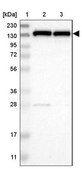 Anti-UBE4B antibody produced in rabbit Prestige Antibodies® Powered by Atlas Antibodies, affinity isolated antibody, buffered aqueous glycerol solution