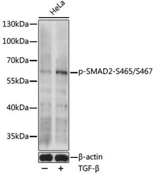 Anti-Phospho-SMAD2-S465/S467 antibody produced in rabbit