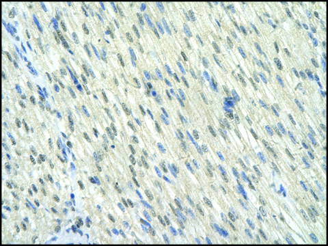 Anti-KLF10 antibody produced in rabbit affinity isolated antibody