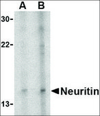 Anti-Neuritin antibody produced in rabbit affinity isolated antibody, buffered aqueous solution