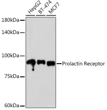 Anti-Prolactin Receptor Antibody, clone 9B10J3, Rabbit Monoclonal