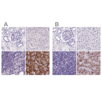 Anti-PDIA2 antibody produced in rabbit Prestige Antibodies&#174; Powered by Atlas Antibodies, affinity isolated antibody, buffered aqueous glycerol solution