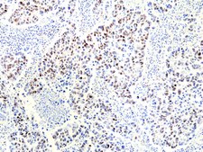 Anti-RNASEH2B Rabbit Monoclonal Antibody affinity purified immunoglobulin