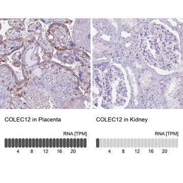 Anti-COLEC12 antibody produced in rabbit Prestige Antibodies&#174; Powered by Atlas Antibodies, affinity isolated antibody, buffered aqueous glycerol solution