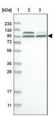 Anti-ROR2 antibody produced in rabbit Prestige Antibodies® Powered by Atlas Antibodies, affinity isolated antibody, buffered aqueous glycerol solution