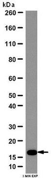 抗线粒体分裂1蛋白（Fis1）抗体 from rabbit, purified by affinity chromatography