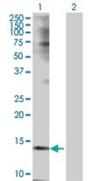 Anti-TSPO antibody produced in rabbit purified immunoglobulin, buffered aqueous solution