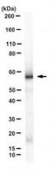 Anti-EBV LMP1 Antibody, clone S12