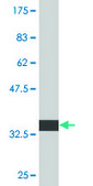 Monoclonal Anti-ALOX15B antibody produced in mouse clone 4A7, purified immunoglobulin, buffered aqueous solution