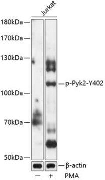 Anti-Phospho-Pyk2-Y402 antibody produced in rabbit