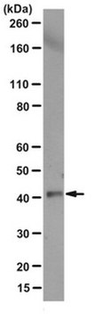 Anti-Actin Antibody, clone JLA20 clone JLA20, from mouse