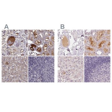 Anti-AFM antibody produced in rabbit Prestige Antibodies&#174; Powered by Atlas Antibodies, affinity isolated antibody