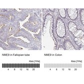 Anti-NME9 antibody produced in rabbit Prestige Antibodies® Powered by Atlas Antibodies, affinity isolated antibody, buffered aqueous glycerol solution