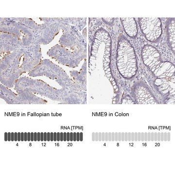 Anti-NME9 antibody produced in rabbit Prestige Antibodies&#174; Powered by Atlas Antibodies, affinity isolated antibody, buffered aqueous glycerol solution