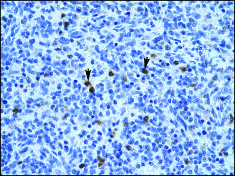 Anti-ANXA3 (AB1) antibody produced in rabbit IgG fraction of antiserum