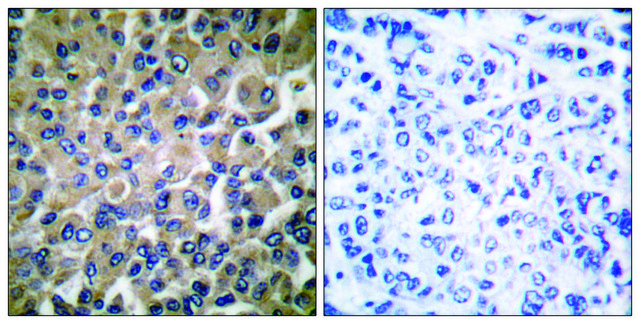 抗-GRP78 兔抗 affinity isolated antibody