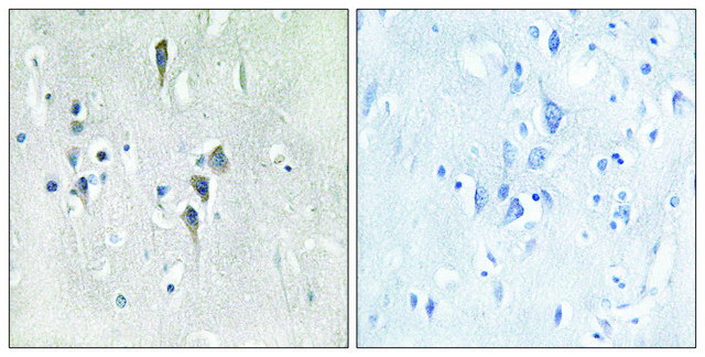 抗-CAMK2 兔抗 affinity isolated antibody