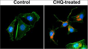 Anti-LC3B antibody, Rabbit Monoclonal recombinant, expressed in HEK 293 cells, clone RM293, purified immunoglobulin