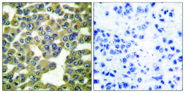 Anti-MMP-13 antibody produced in rabbit affinity isolated antibody