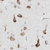 Anti-LRRC59 antibody produced in rabbit Prestige Antibodies® Powered by Atlas Antibodies, affinity isolated antibody, buffered aqueous glycerol solution