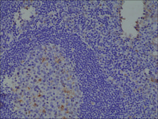 Anti-Spastin antibody, Rabbit monoclonal recombinant, expressed in HEK 293 cells, clone RM346, purified immunoglobulin