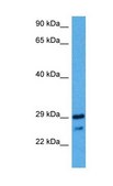 Anti-NKX2-2, (N-terminal) antibody produced in rabbit affinity isolated antibody